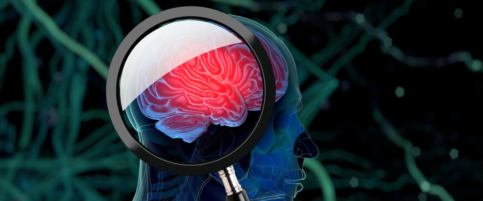 How long does it take for brain chemistry to return to normal?